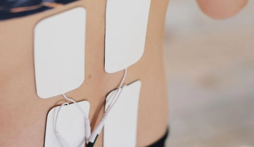 TENS MACHINE HIRE - PORT/SOUTH HEDLAND